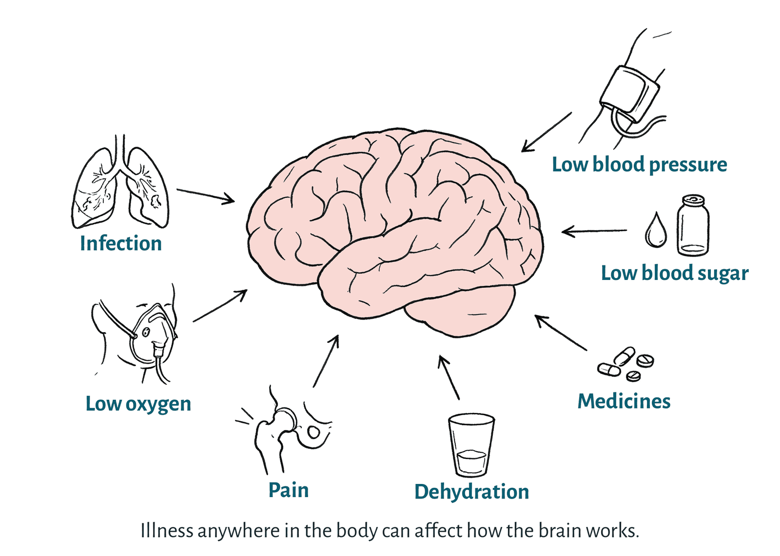 A drawing of the brain with arrows pointing to it from problems in the body: infection, low oxygen, pain, dehydration, medicines, low blood sugar and low blood pressure.